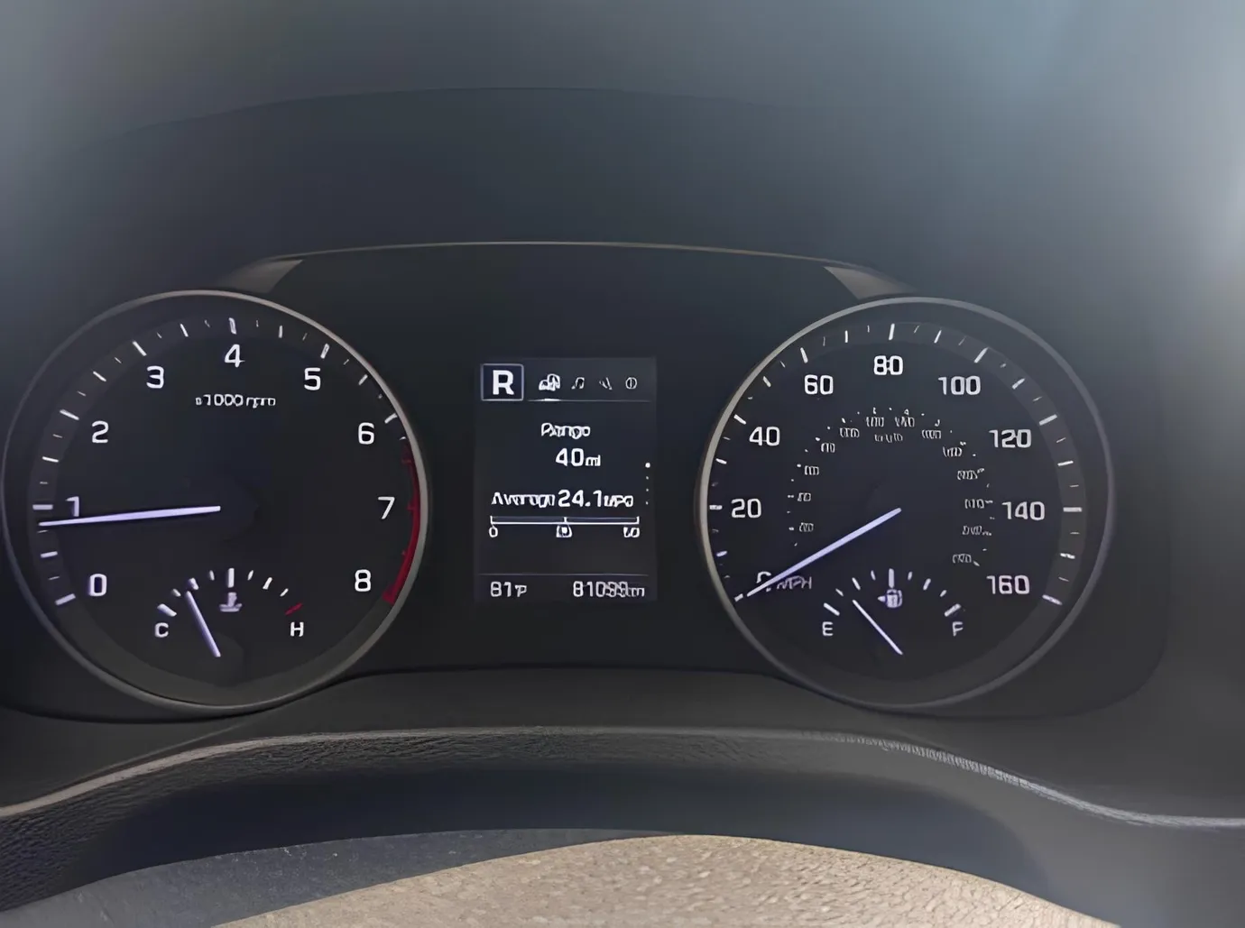 Hyundai Elantra, 2.0 L, 2017 год, 130 516 km, Баку - Цена: 21 500 ₼ - Tunel.az