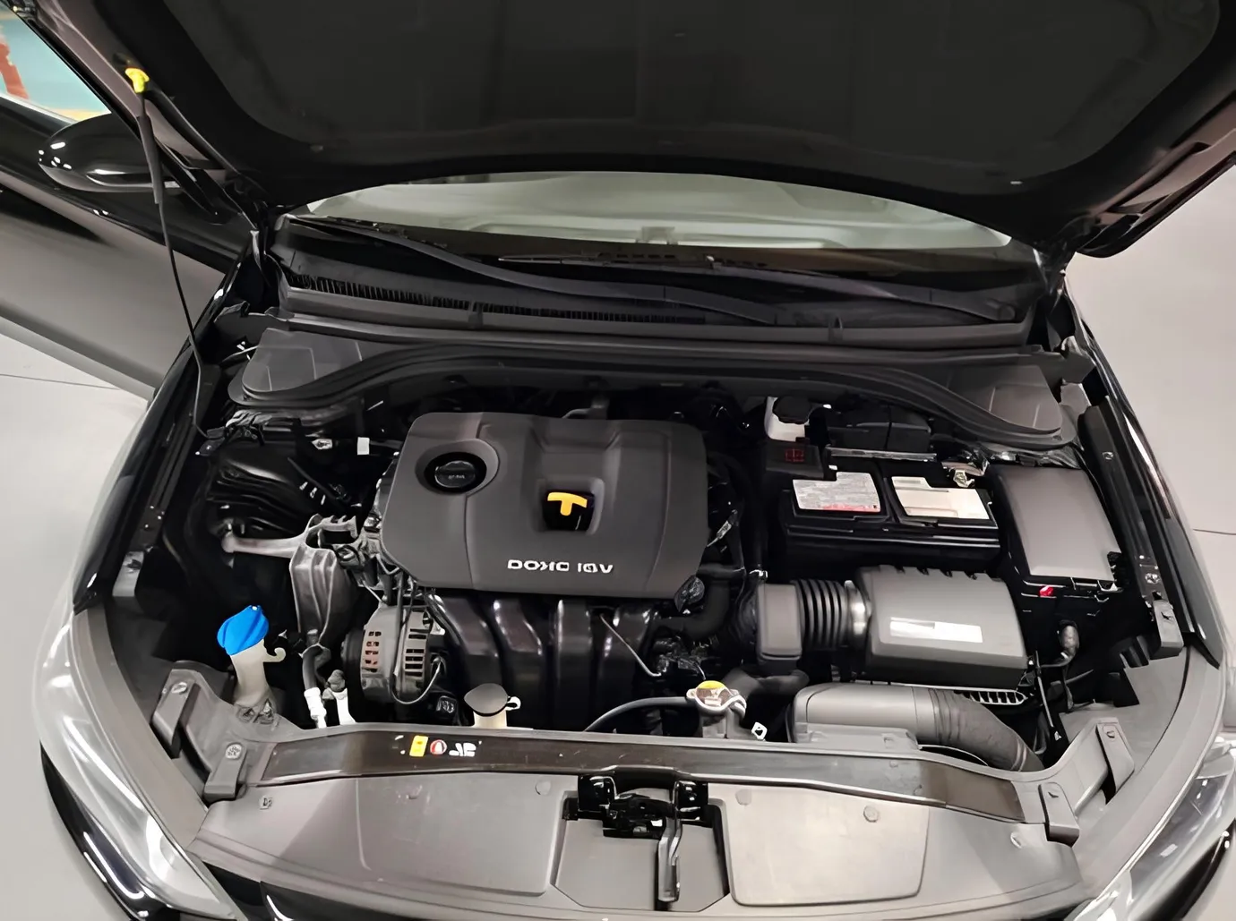 Hyundai Elantra, 2.0 L, 2017 i̇l, 96 000 km, Bakı - Qiymət: 22 000 ₼ - Tunel.az